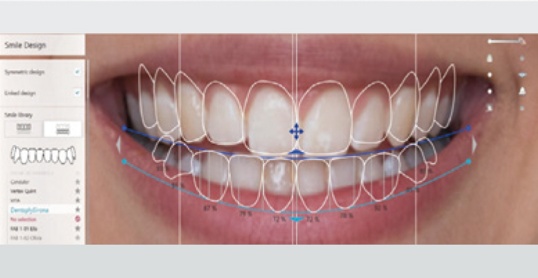 triois-004
